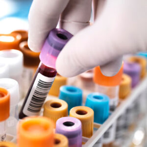 Iron Infusion ، Iron Deficiency