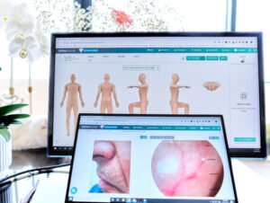 Mole mapping Capstone Medical Centre Southbank