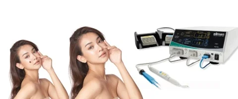 Cosmetic-Mole-Removal-Capstone-Medical-Southbank-mobile - Capstone Medical Centre Southbank Cosmetic Mole Removal Capstone Medical Southbank - Mobile