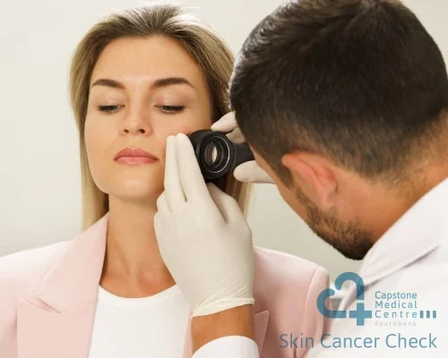 Skin-Cancer-Check-Clinic-Southbank-min - Capstone Medical Centre Southbank