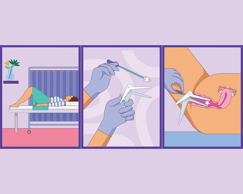 The Cervical Screen Test Procedure