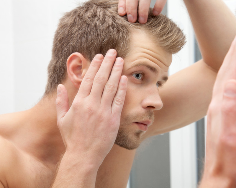 Preventing Hair Loss During Weight Loss