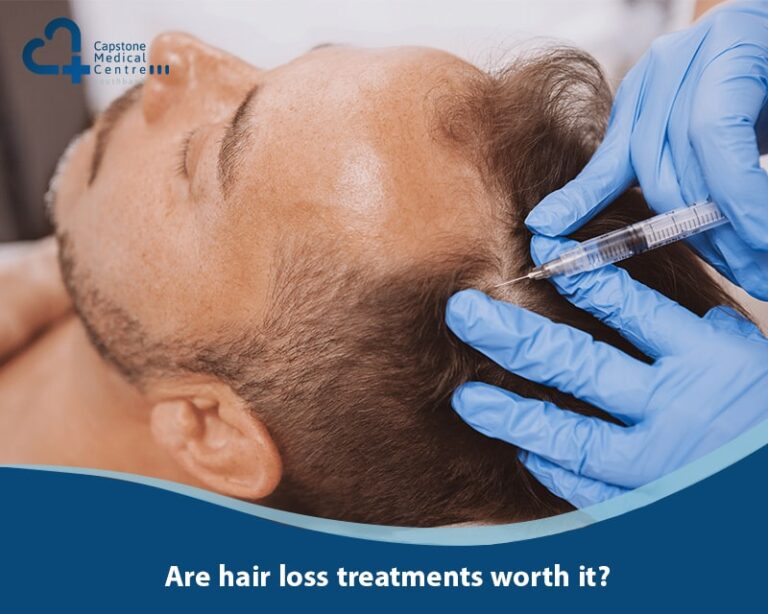 Are hair loss treatments worth it
