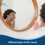 Different types of skin cancer