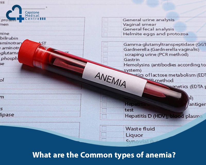 What are the Common types of anemia?
