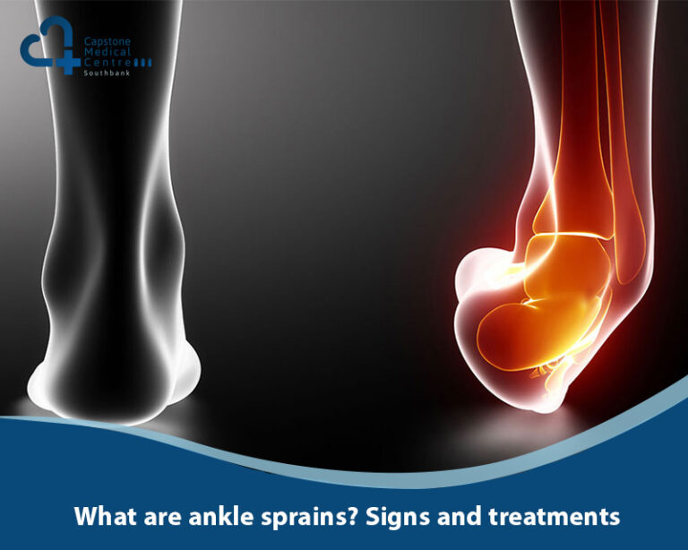 What are ankle sprains? Signs and treatments