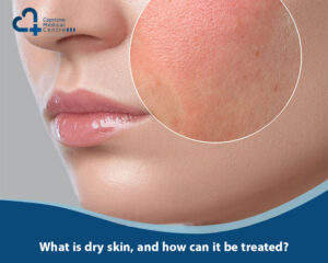 What is dry skin, and how can it be treated