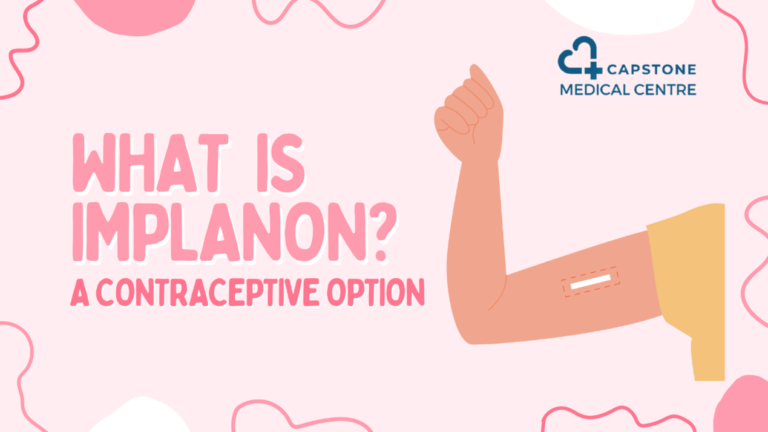 What is a Contraceptive Implant?